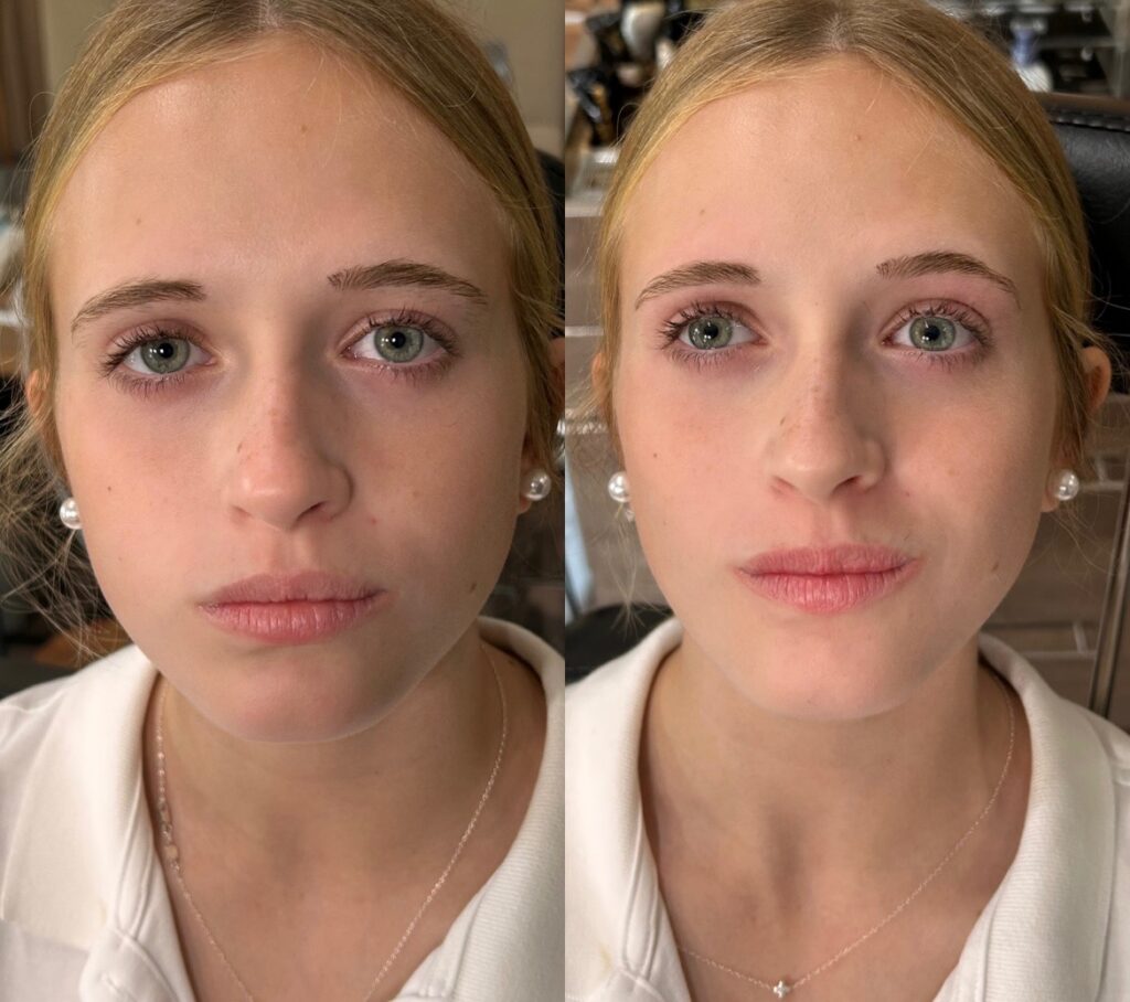 before and after brow photos of an Authentic Beauty client in Atlanta 